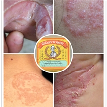 泰国将军标强效药膏手足癣香港脚牛皮癣顽癣湿疹一切皮肤病20g