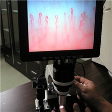 供应高清QY-990微循环检测仪