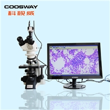厂家直供40x-1600x放大高清晰一滴血检测仪特价5200