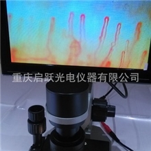 供应血管观察仪微循环检查仪配超薄精美显示器可安装到仪器上