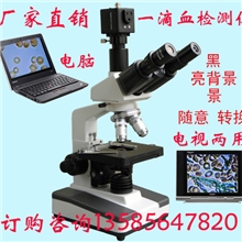 厂家直销高清电脑电视两用双目一滴血检测仪黑背景MDI检测仪