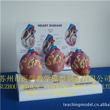 SMD0882EA3部件心脏模型3pcsheartmodel