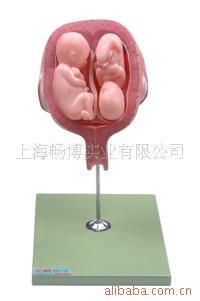 供应五个月双胞胎模型
