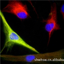 RecombinantHumanFGF-acidic50ug