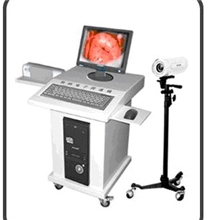 供应阴道镜数码电子阴道镜便宜电子阴道镜