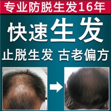 特效毛发生长液,防脱浓密,生发剂十五天显效贴牌支持小批量