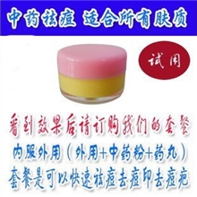 祛痘霜粉刺去痘痤疮祛痘膏中药祛痘印青春痘去痘印痤疮去暗疮