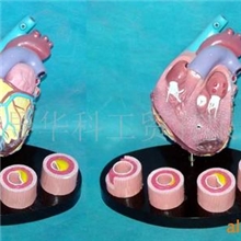 GD0321B054粥样心脏带圆座