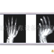 供应德力医用观片灯