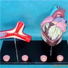 GD0321B056粥样心脏和血管