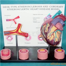 GD0321B055粥样心脏带血管带背板