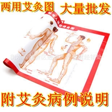 A2尺寸人体经络图/蕲艾条艾灸必备穴位图/附常用病例施灸参考说明