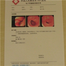 超声医用胶片(单面激光)(简装)