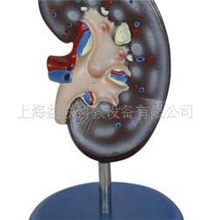 肾解剖模型1件(图)/上海益联科教专业生产