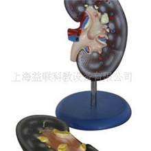 肾解剖模型2件/人体解剖教学模型/医学教学模型
